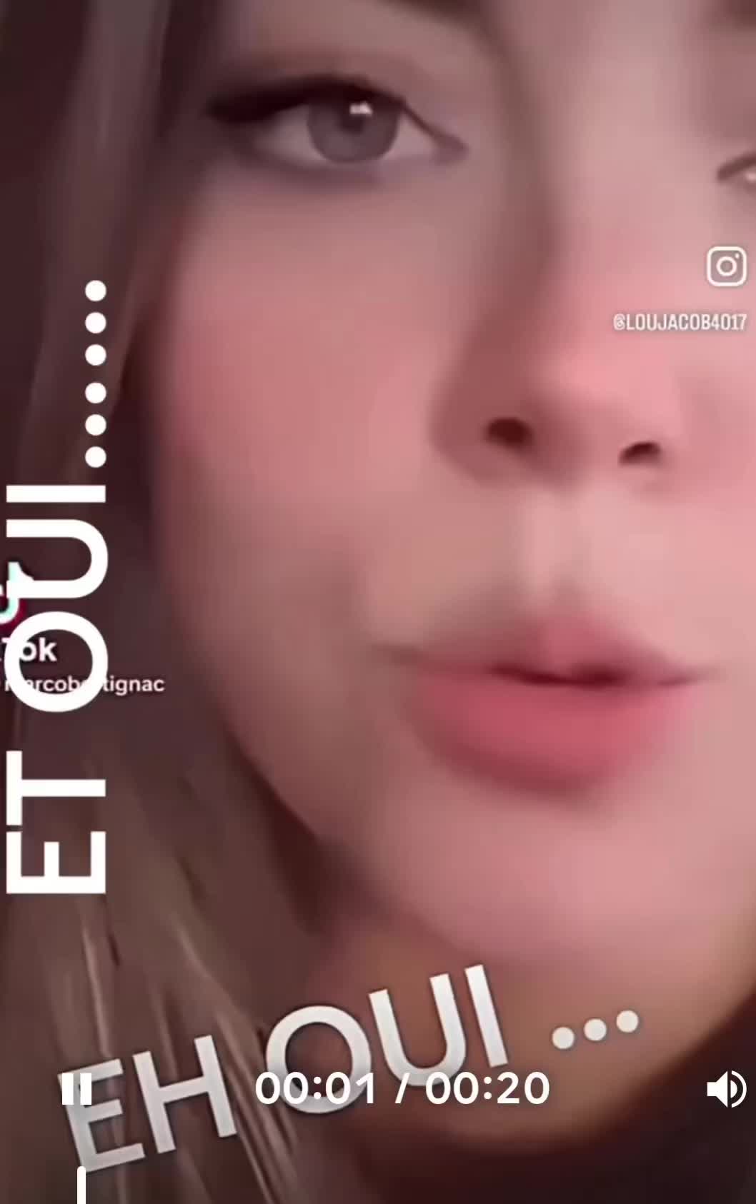 @LOU25000