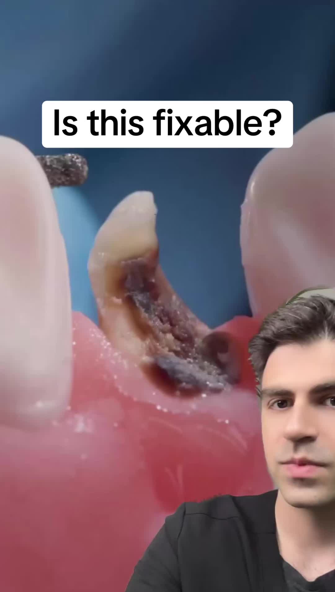 @Dr. Kadish