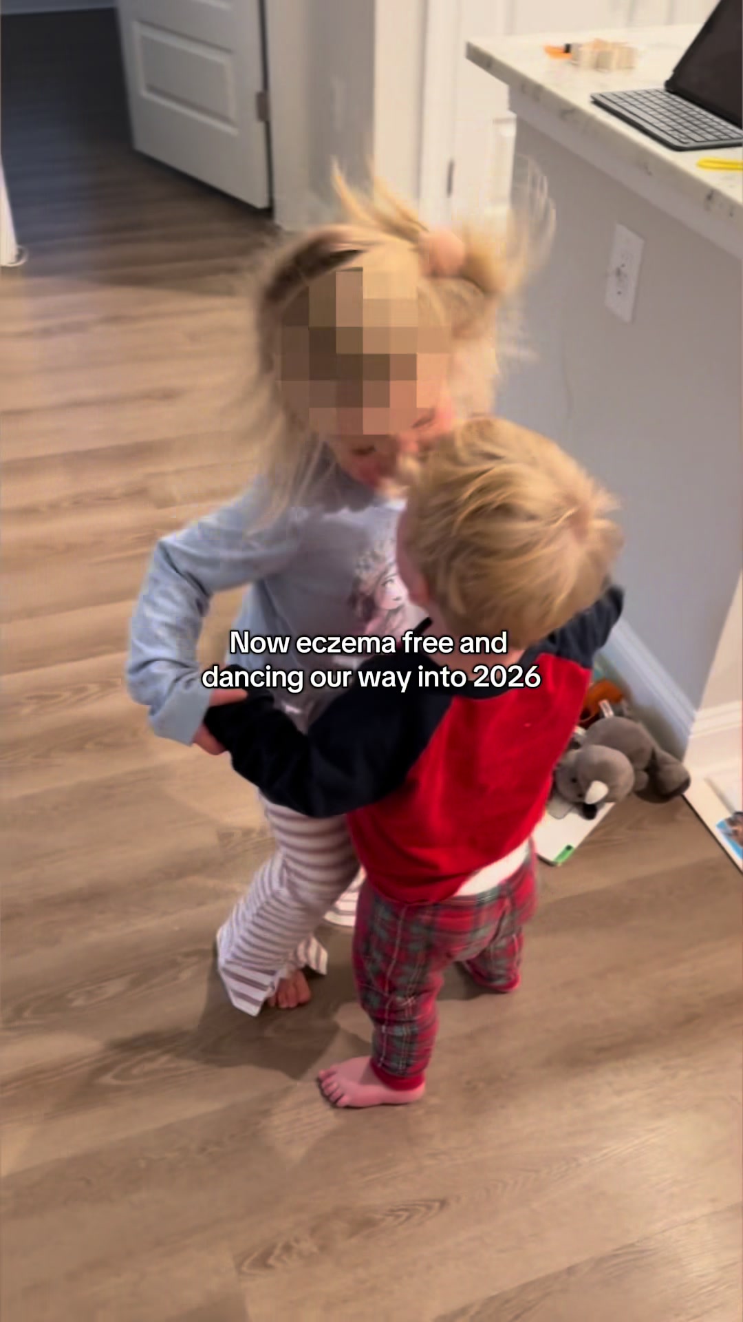 @Eczemama