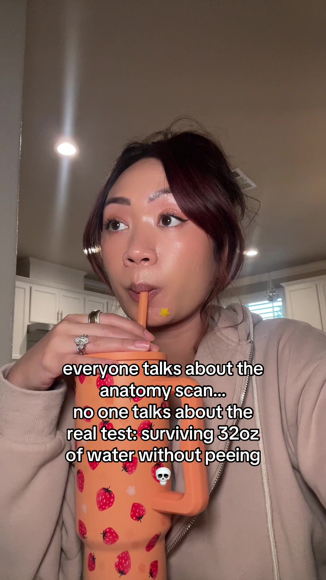 @Jazz