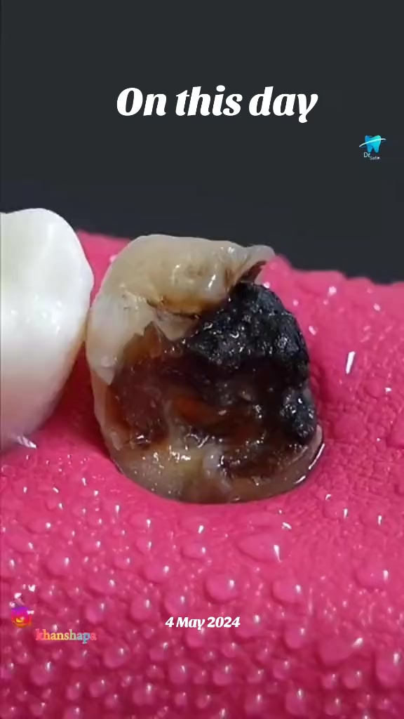 @Dentist 🦷