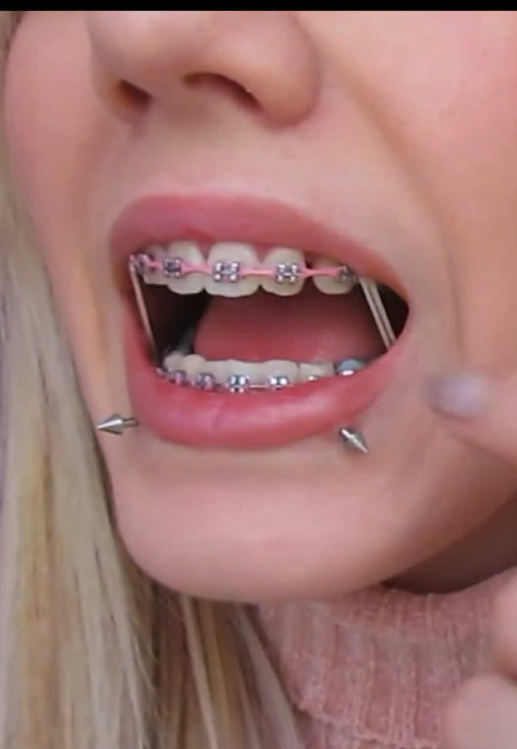 @aaaaa