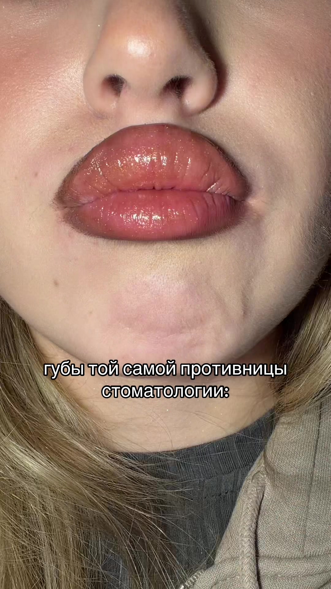 @lipcombovna