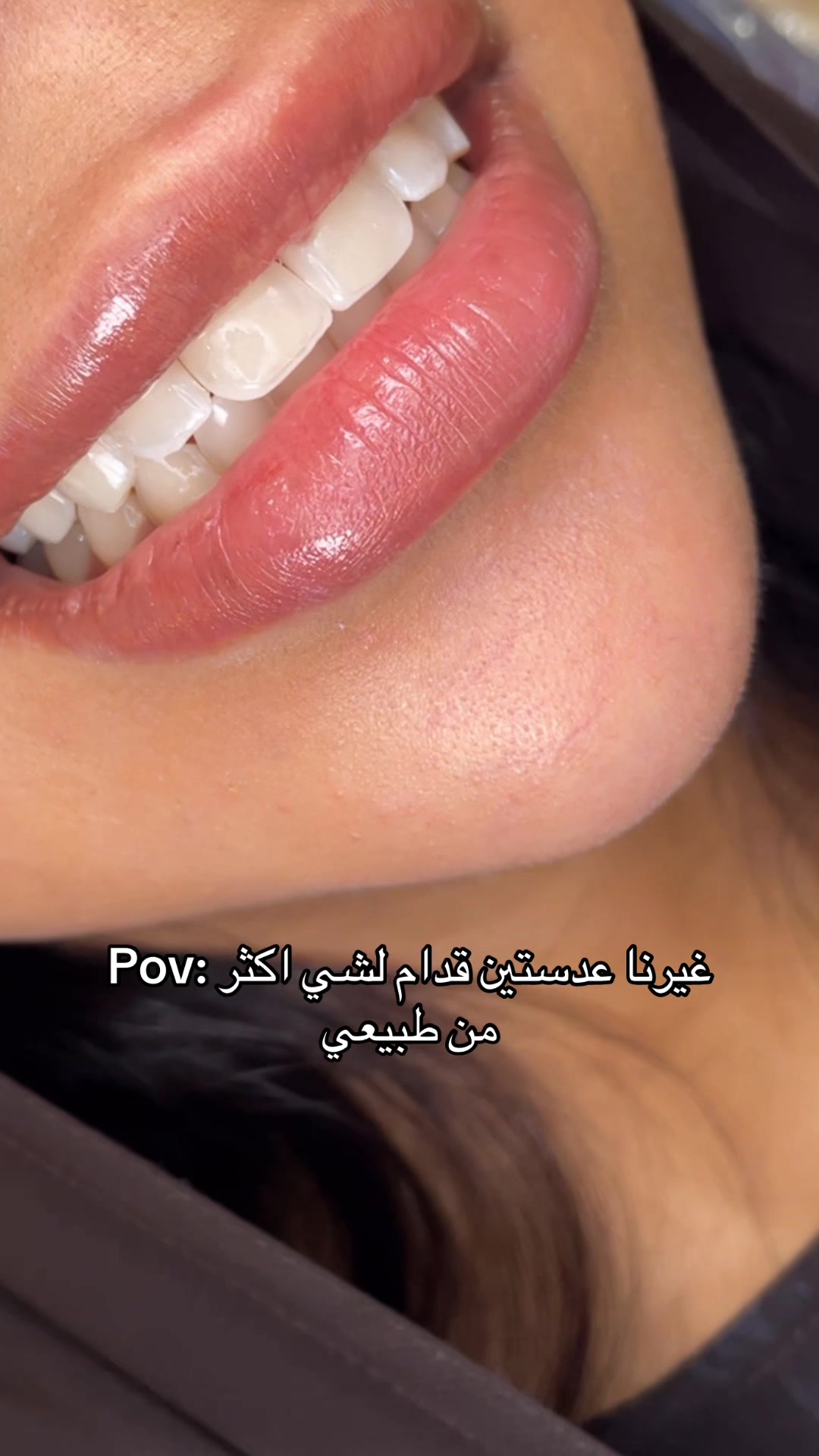 @Dr. Abrar Alhababi