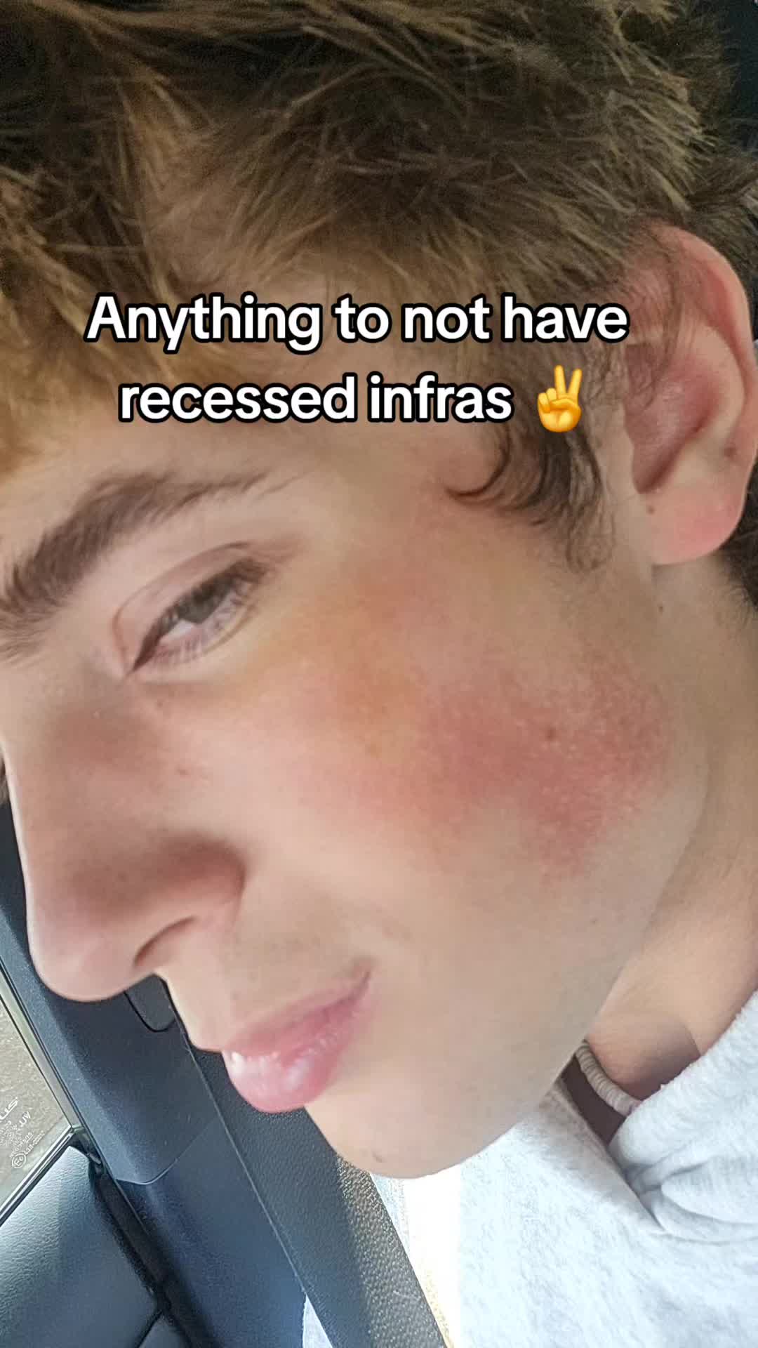 @Herbst