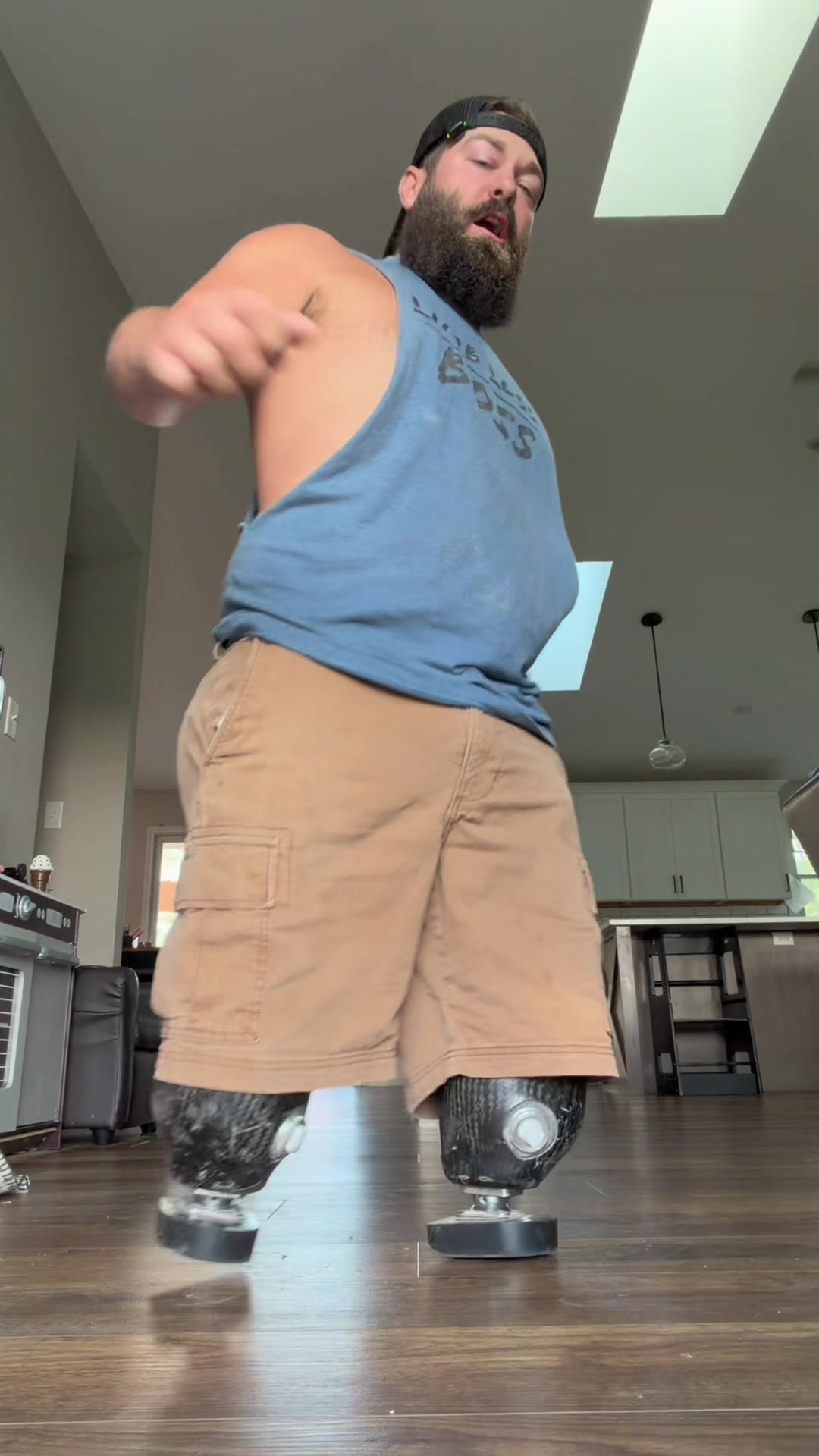 @Limb Loss Boss