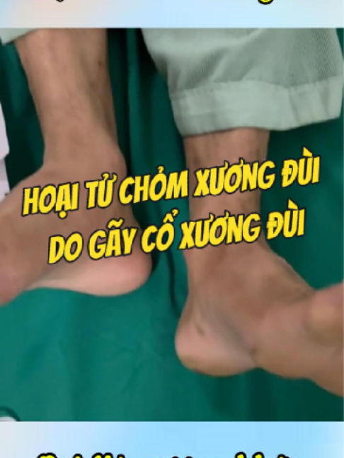 @Chuyên gia xương khớp