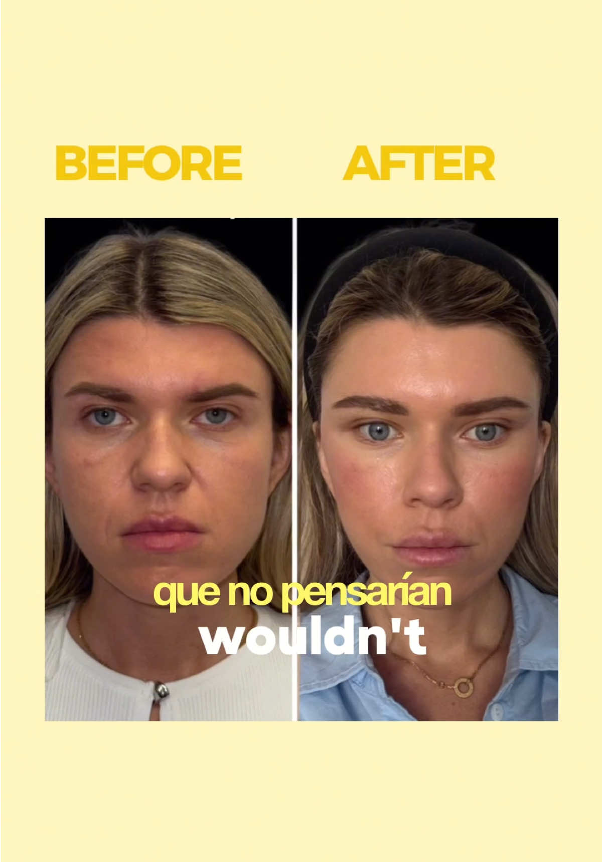 @Dolls Plastic Surgery