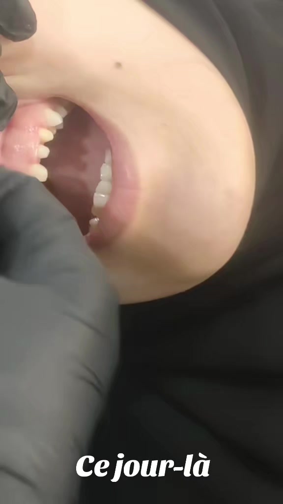 @Dr HASSOUN02 طبيبة الاسنان شلف