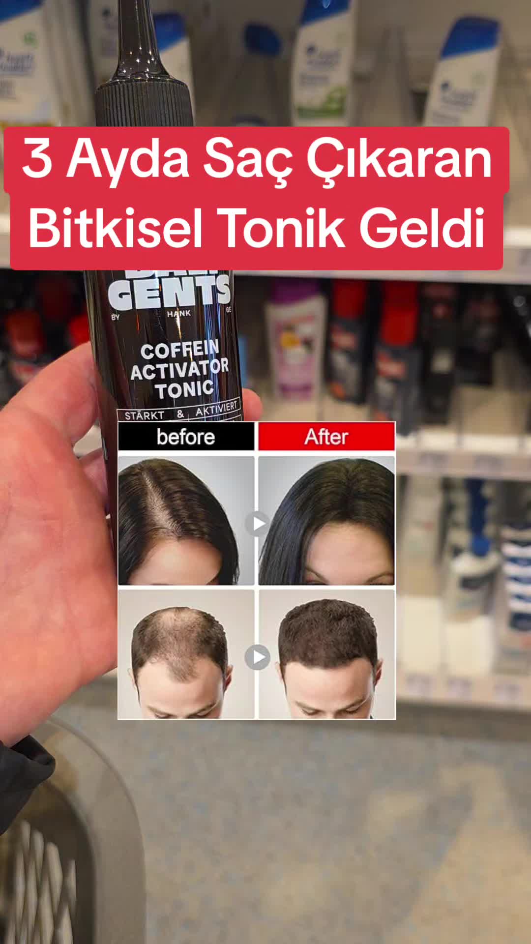 @Gurbet Ana