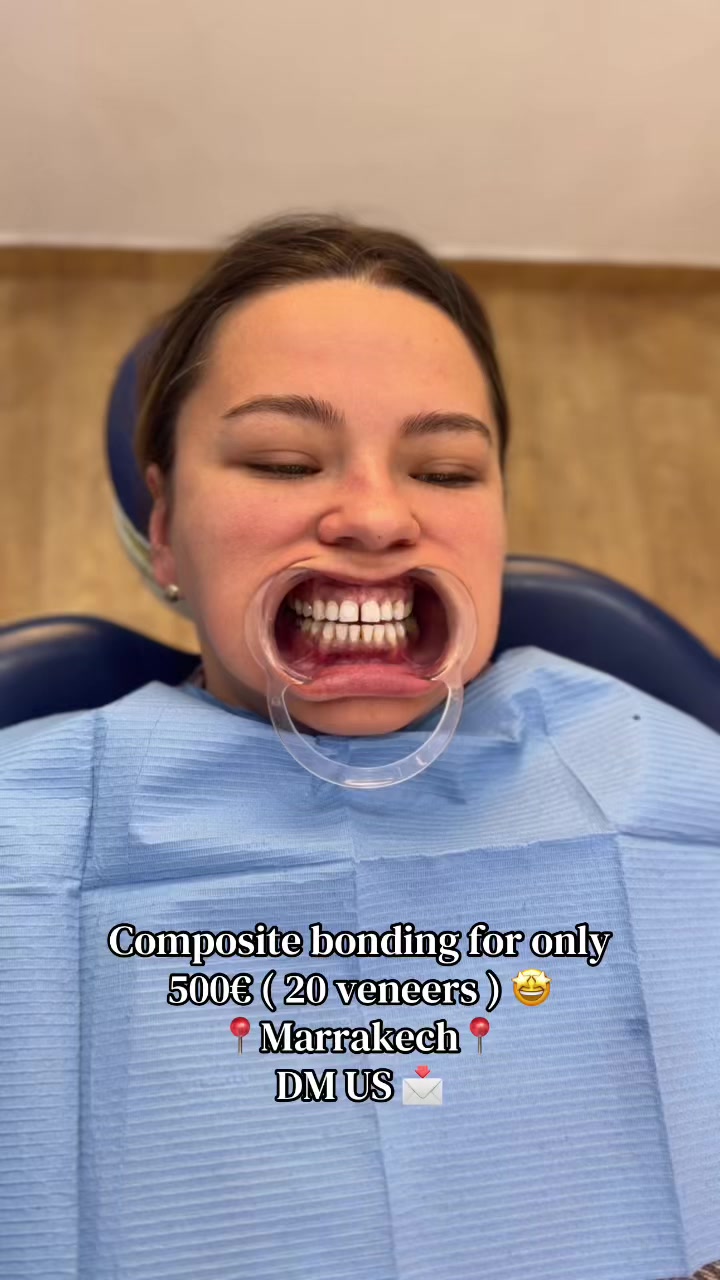 @Smilesecret