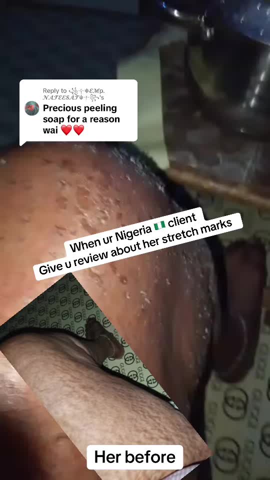 @@ Precious peeling soap