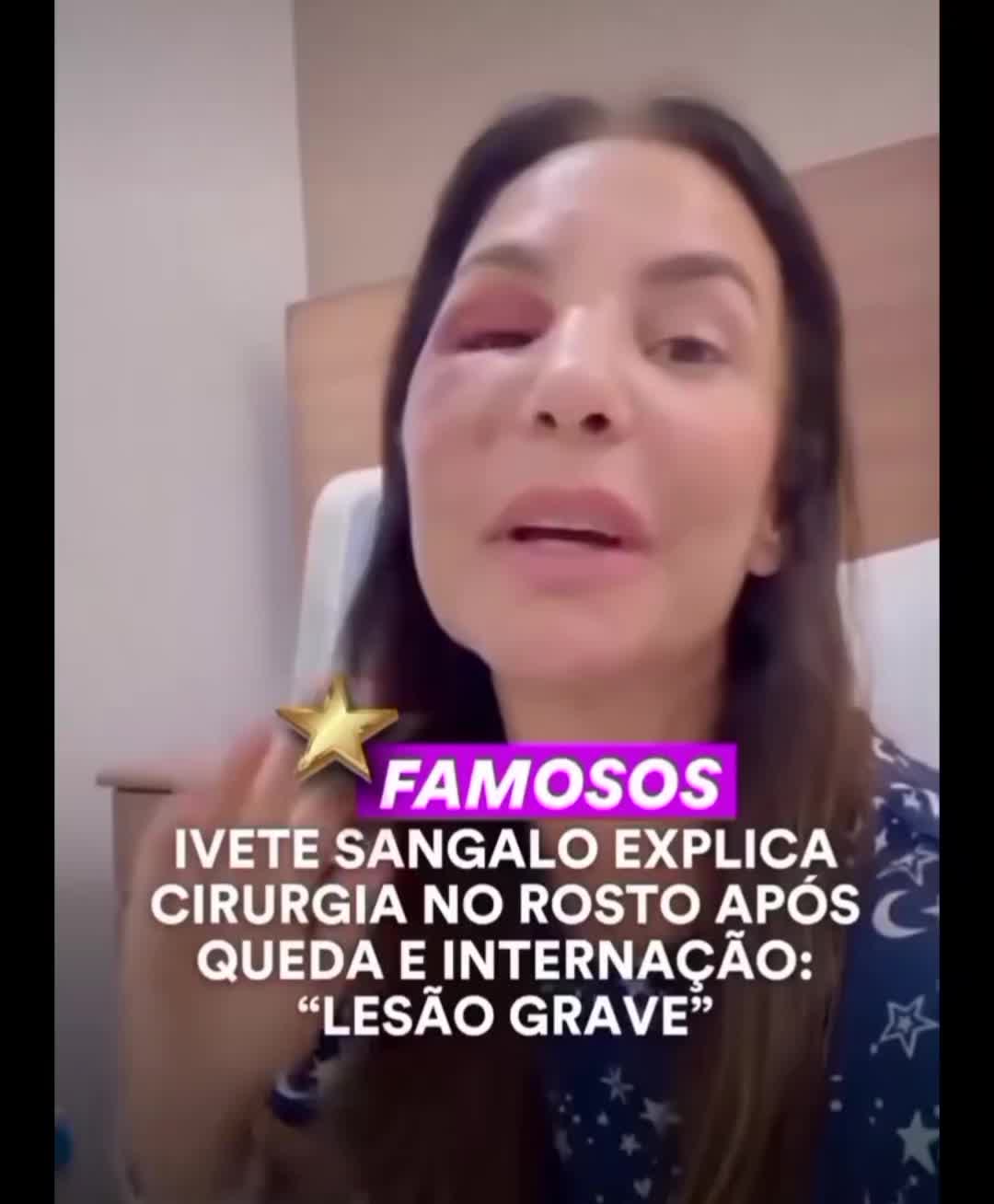 @Eita Atr&aacute;s de vixii