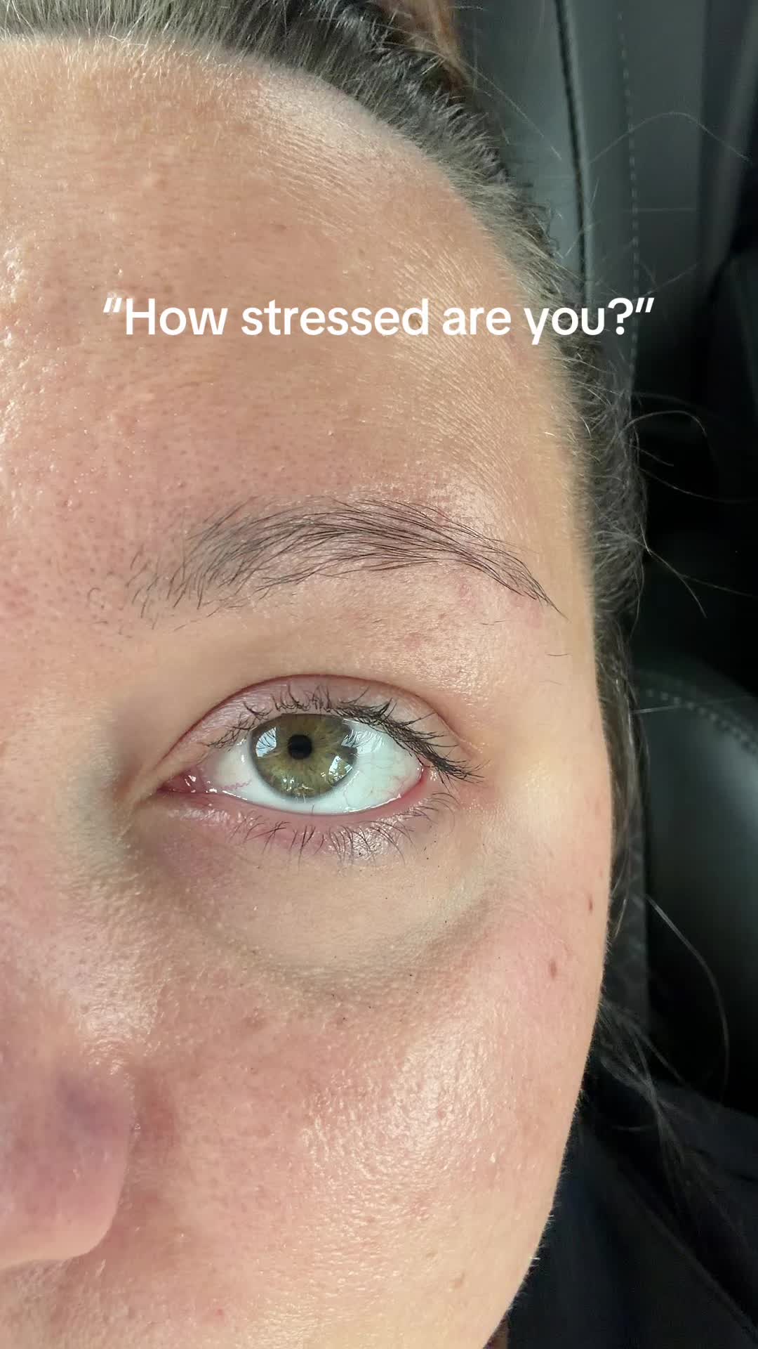 @Ash