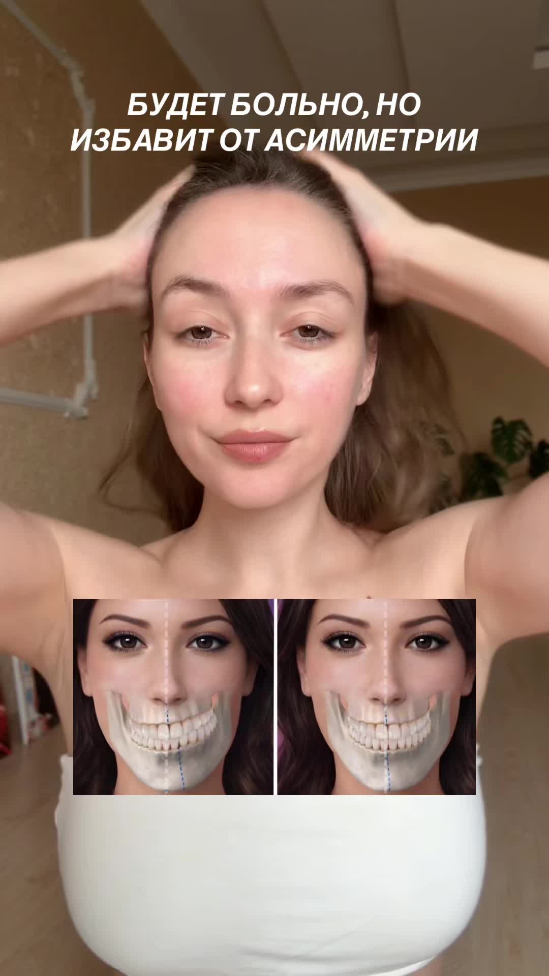 @Фейсбилдинг | Максилла
