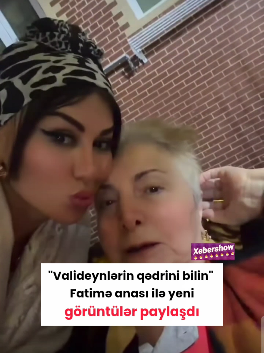 @Xebershow