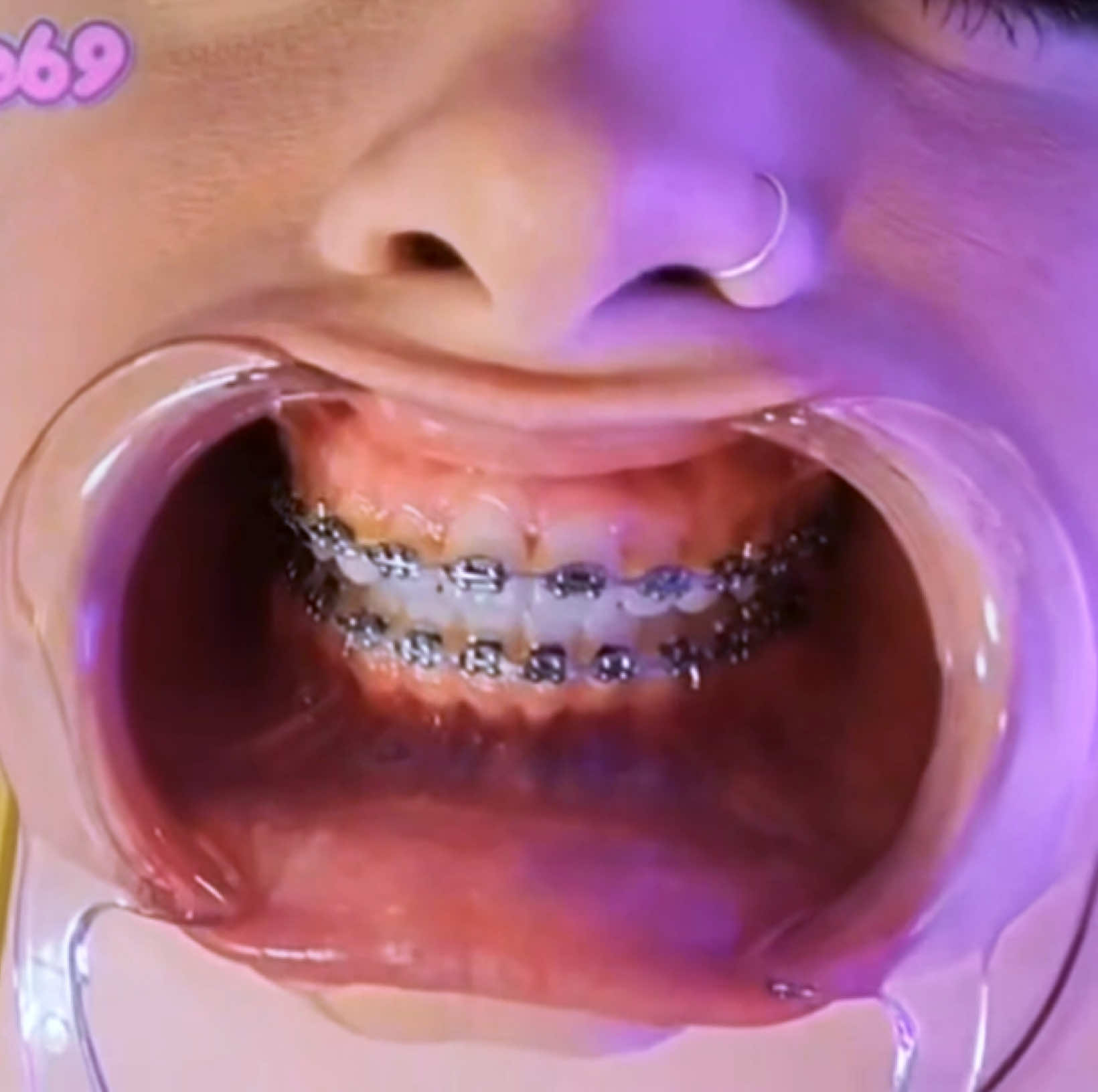 @TeethfairyEvah