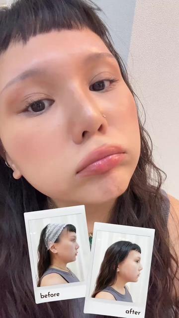 @Standard Skin clinic