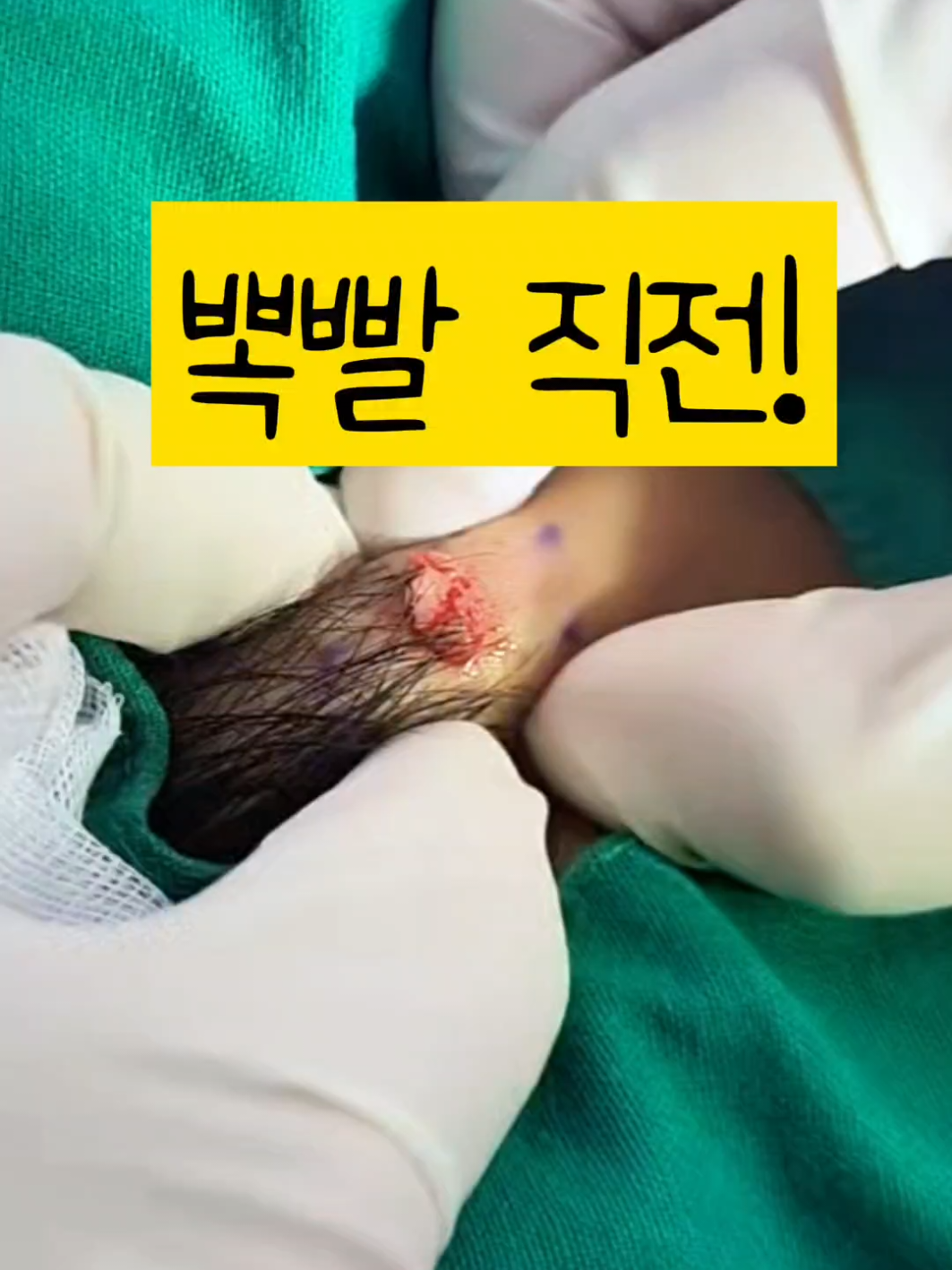 @아문성형외과