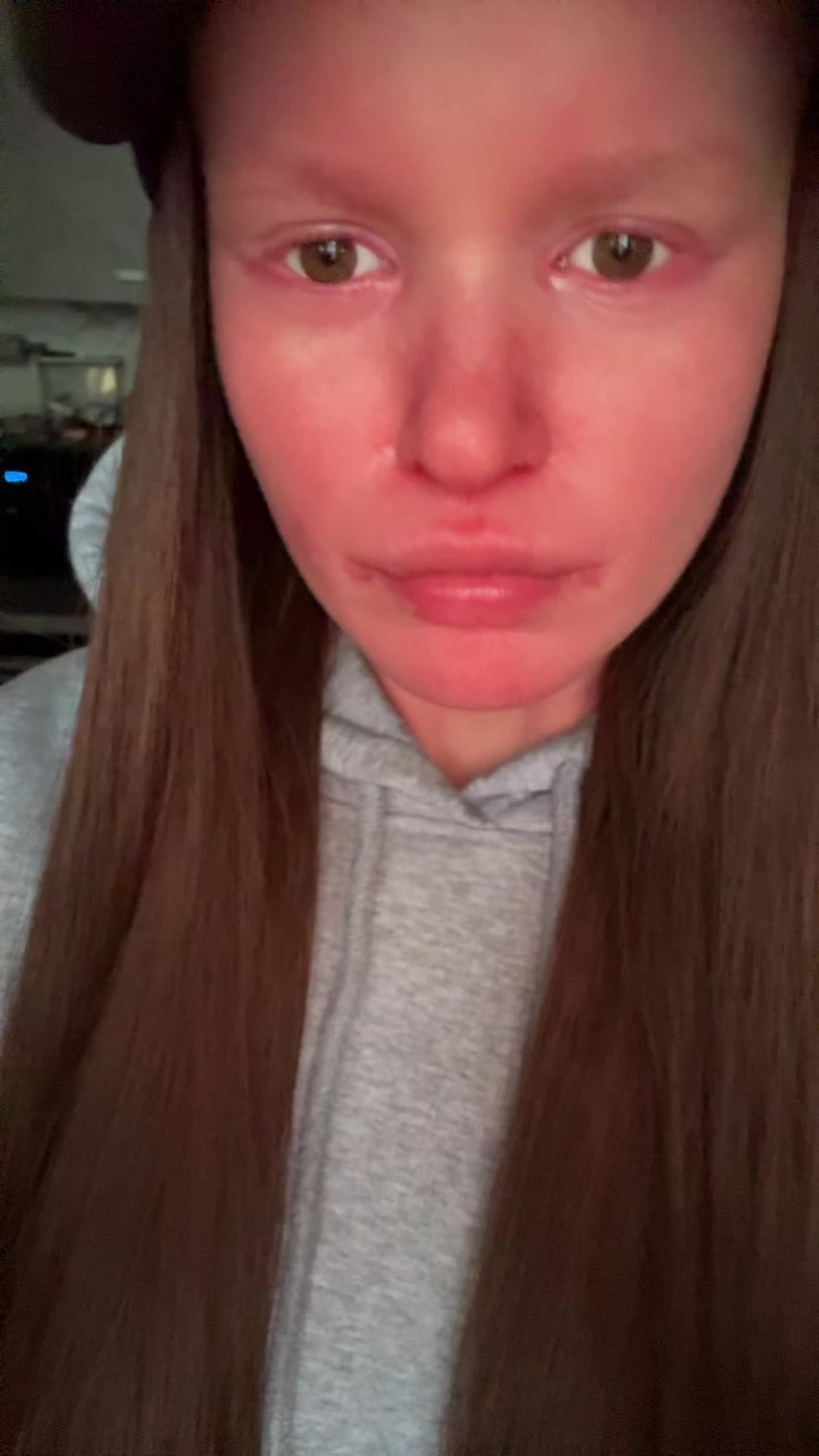 @Toxxzaaa