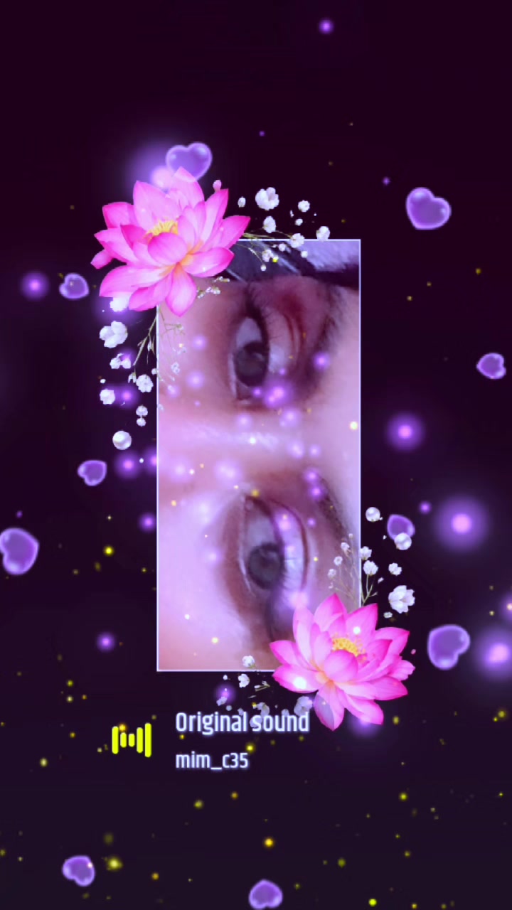 @🆀🆄🅴🅴Ⓝ_Ⓡ🅾🅾Ⓟ🅰