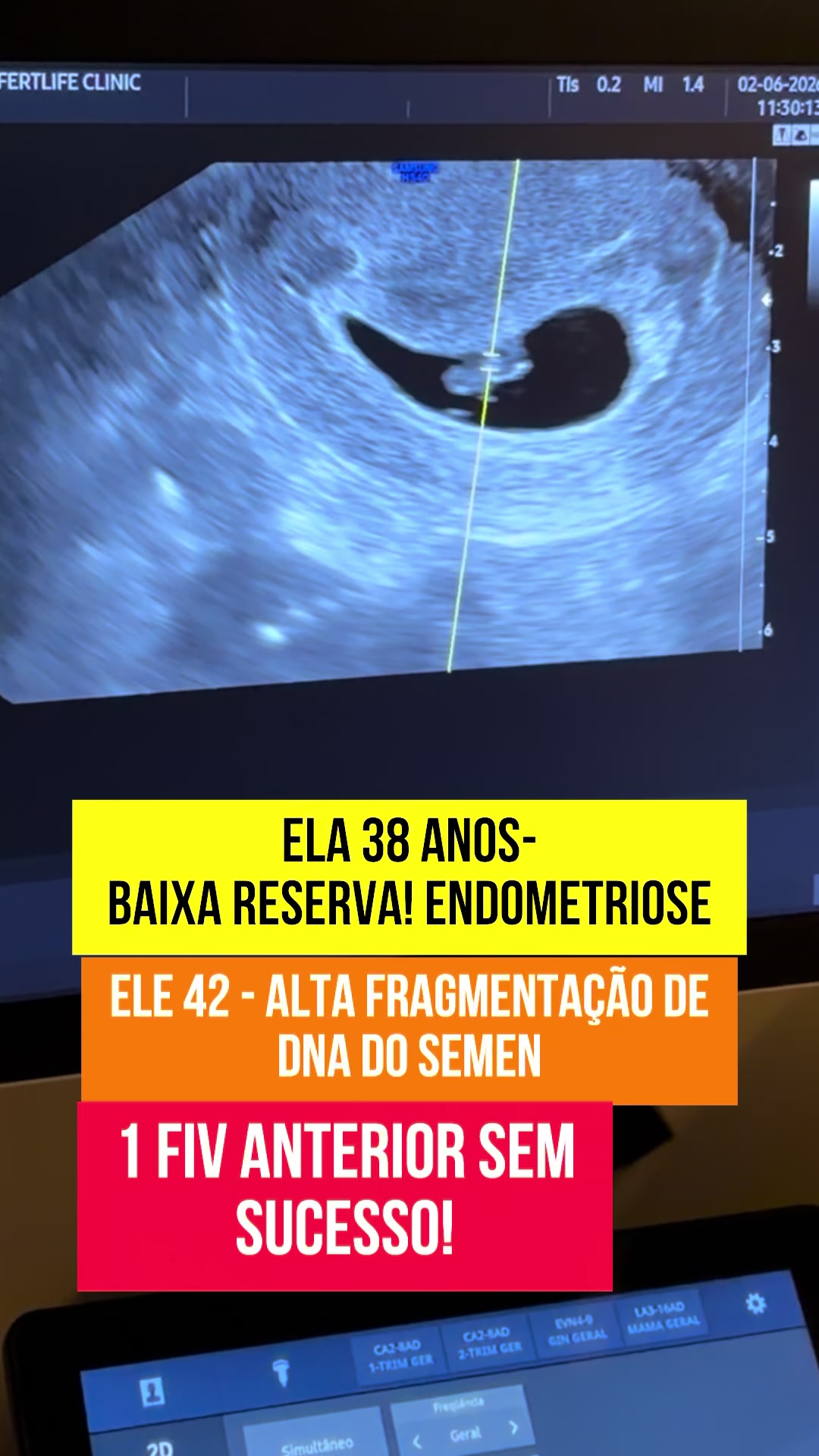 @Dr.ivanpenna