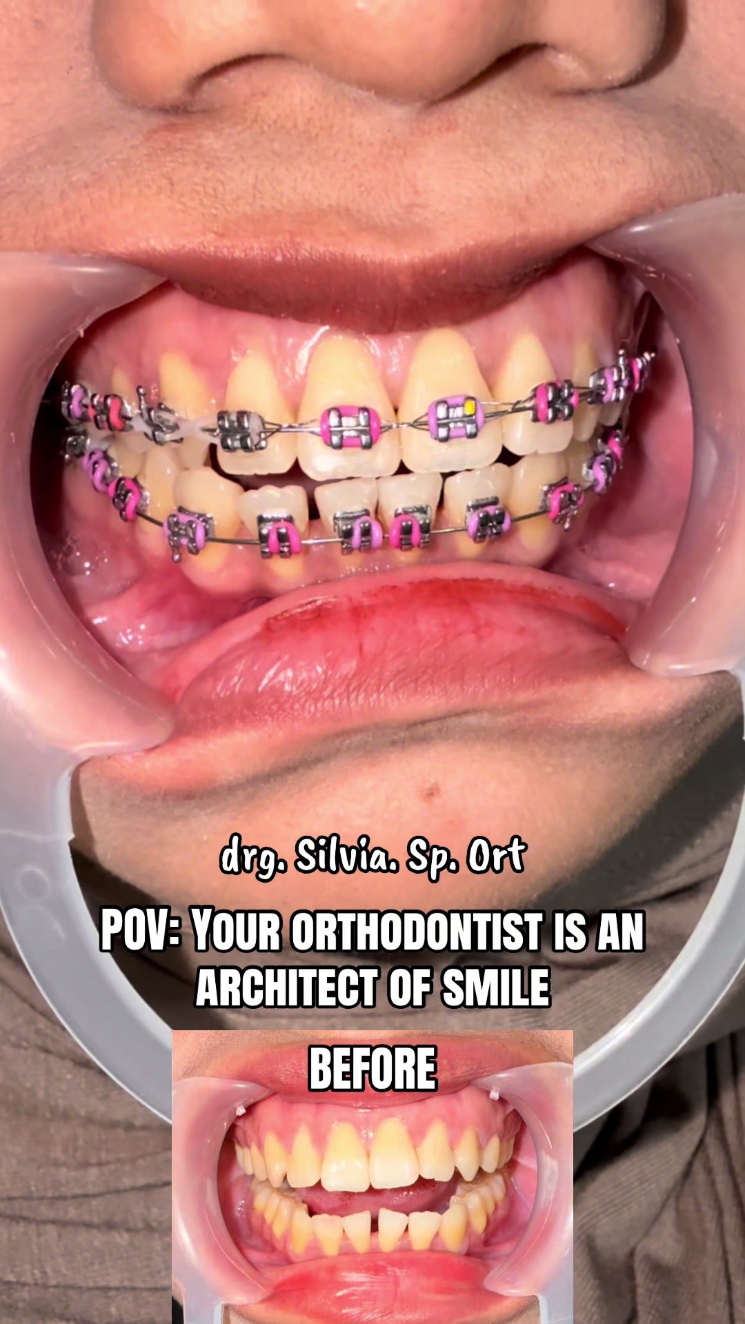 @drg Silvia Sp Ort