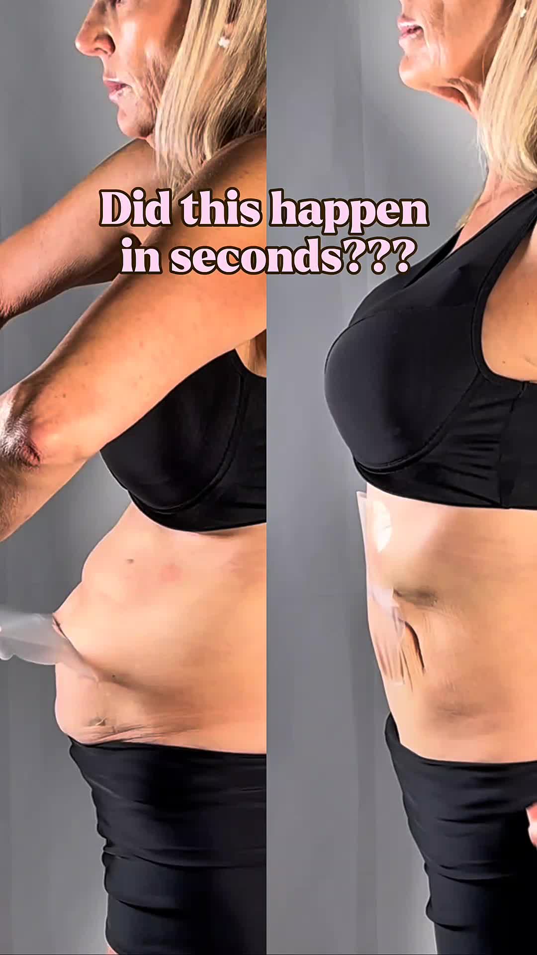 @Skinnies InstantLifts