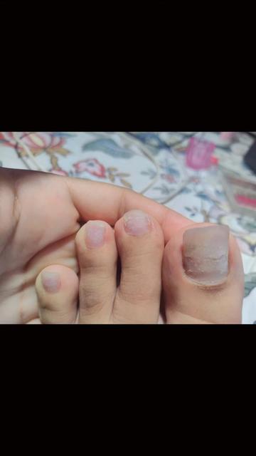 @๐ฅท๐ป๐_MI_NENA_๐๐ฆโ ๏ธ๐ชฌ