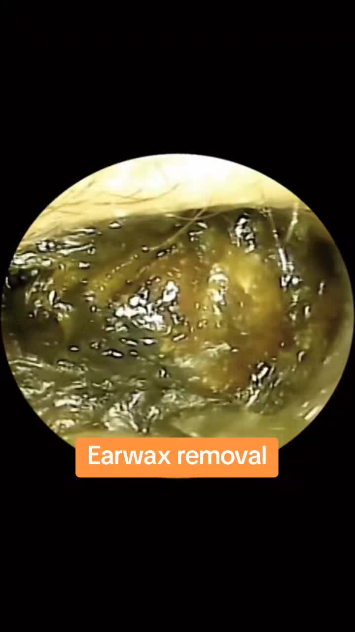 @Earwax.pro