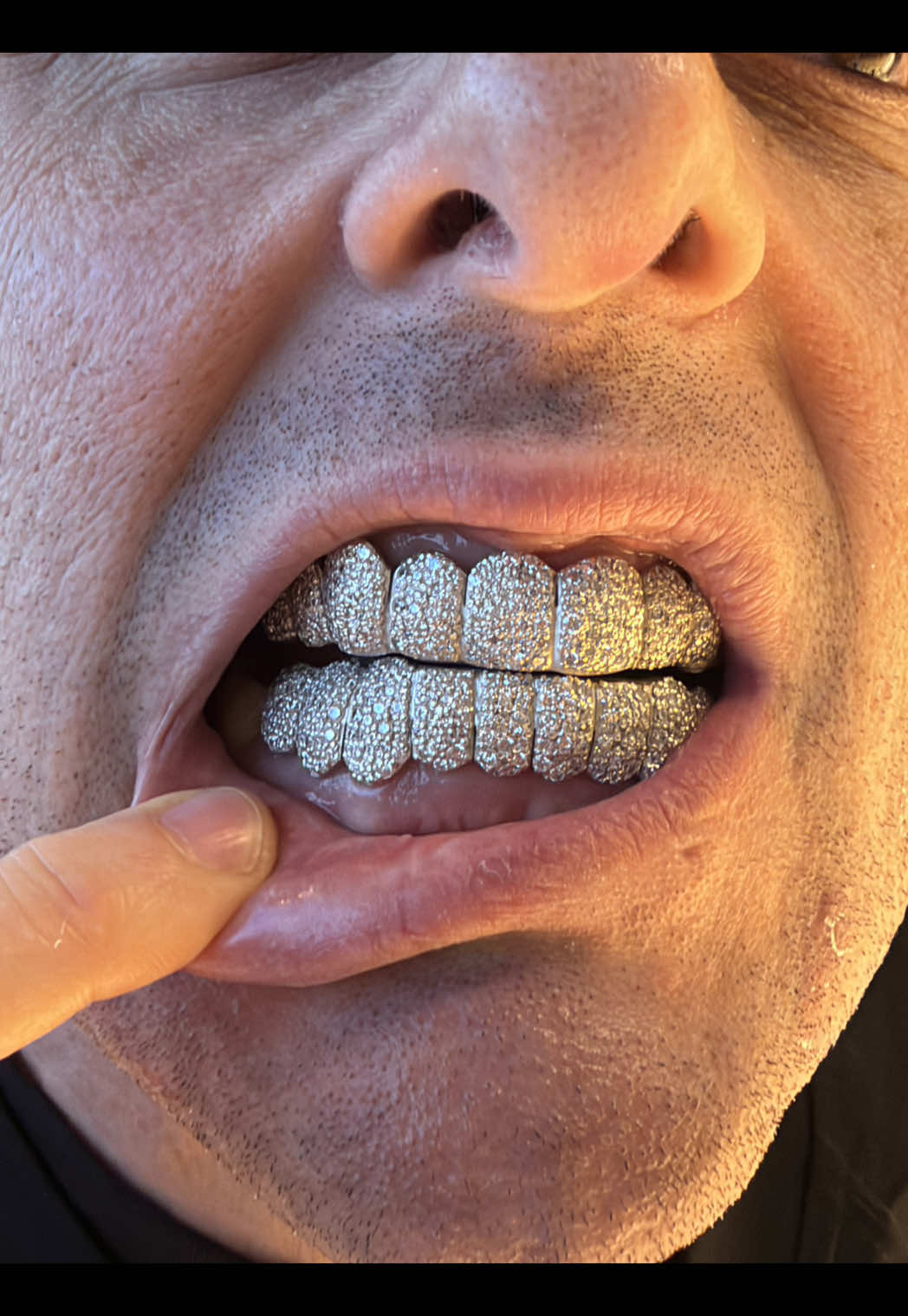@AZ Grillz Plug