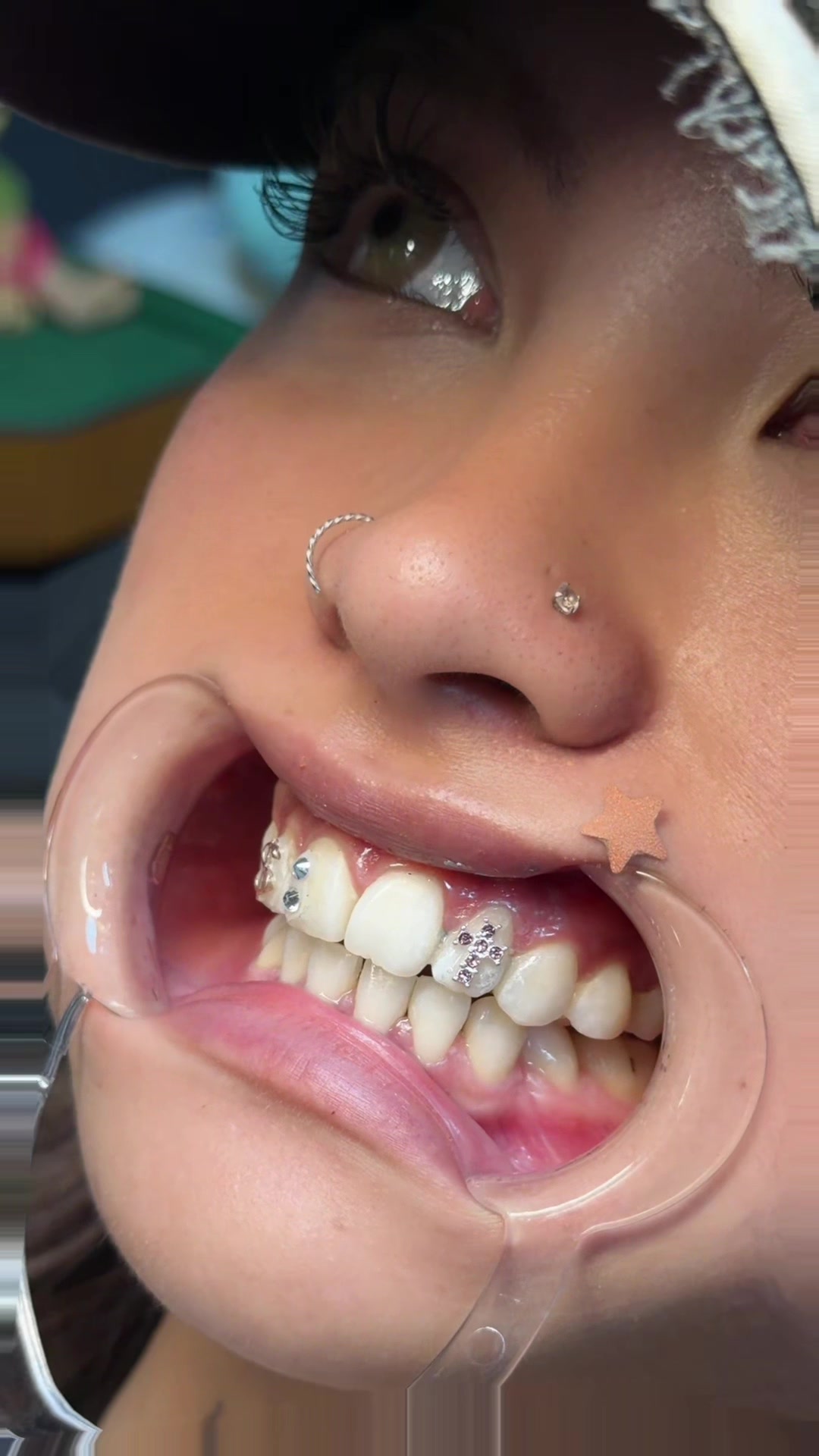 @Xỏ khuyên-ToothGems Vũng Tàu