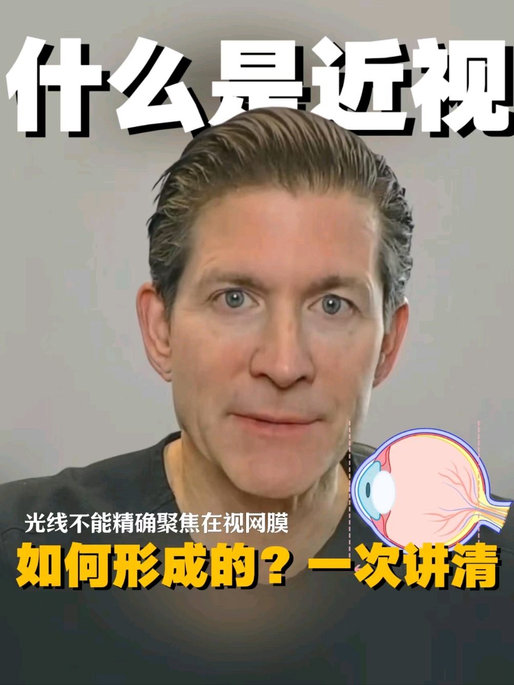 @🇺🇸西雅图/波特兰 King  Lasik 近视老花手术