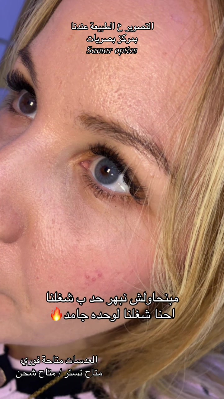 @مركز اخصائية بصريات سمر الجندي
