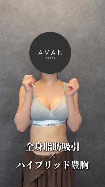 @森脇進/二の腕脂肪吸引・豊胸/AVAN TOKYO
