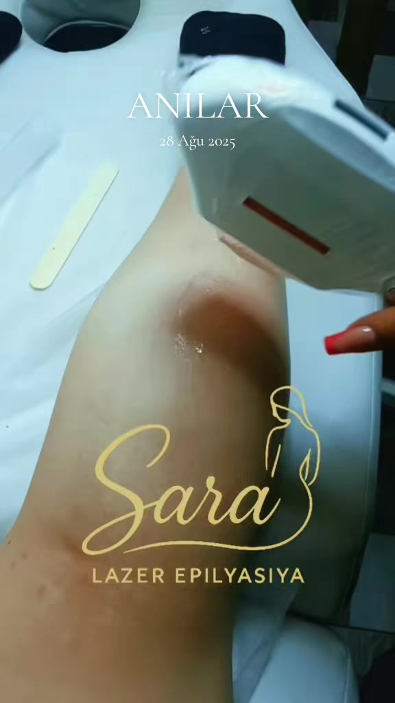 @Lazeroloq Sara Huseyn