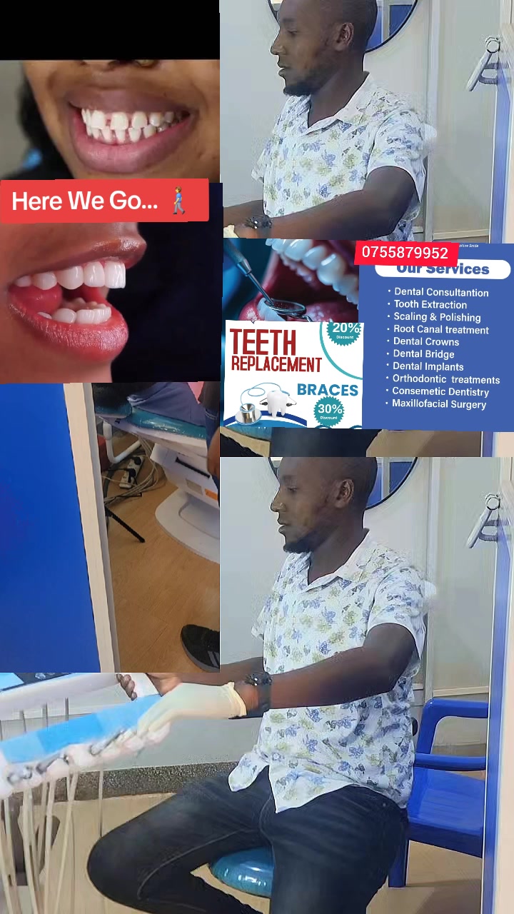 @Allianz Dental studio🦷🦷🇺🇬