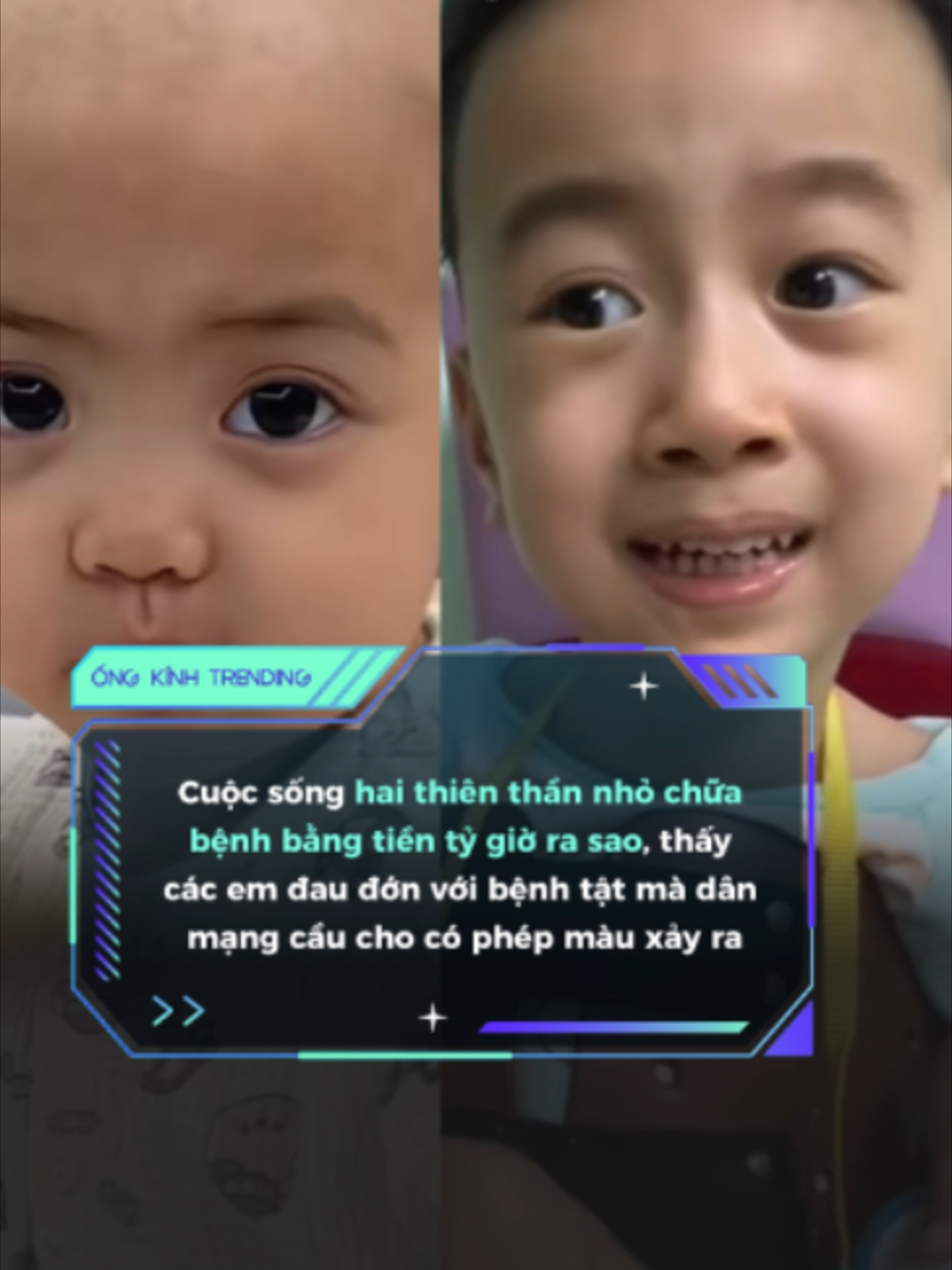 @ỐNG K&Iacute;NH TRENDING