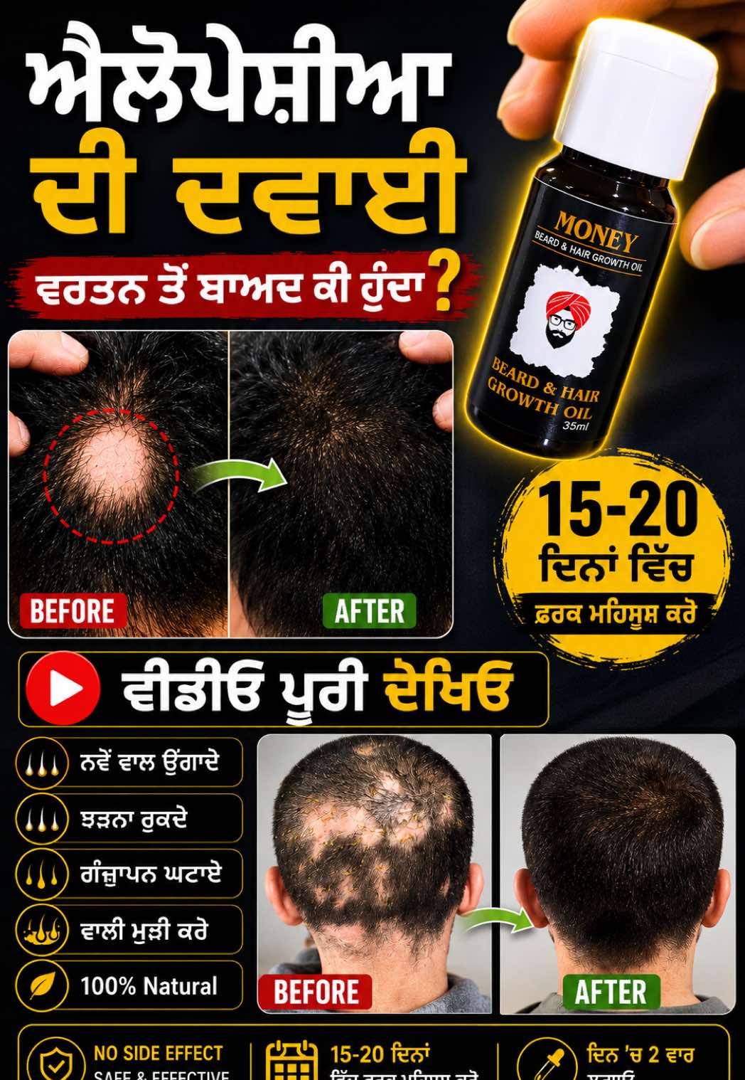 @money_beard_growthoil