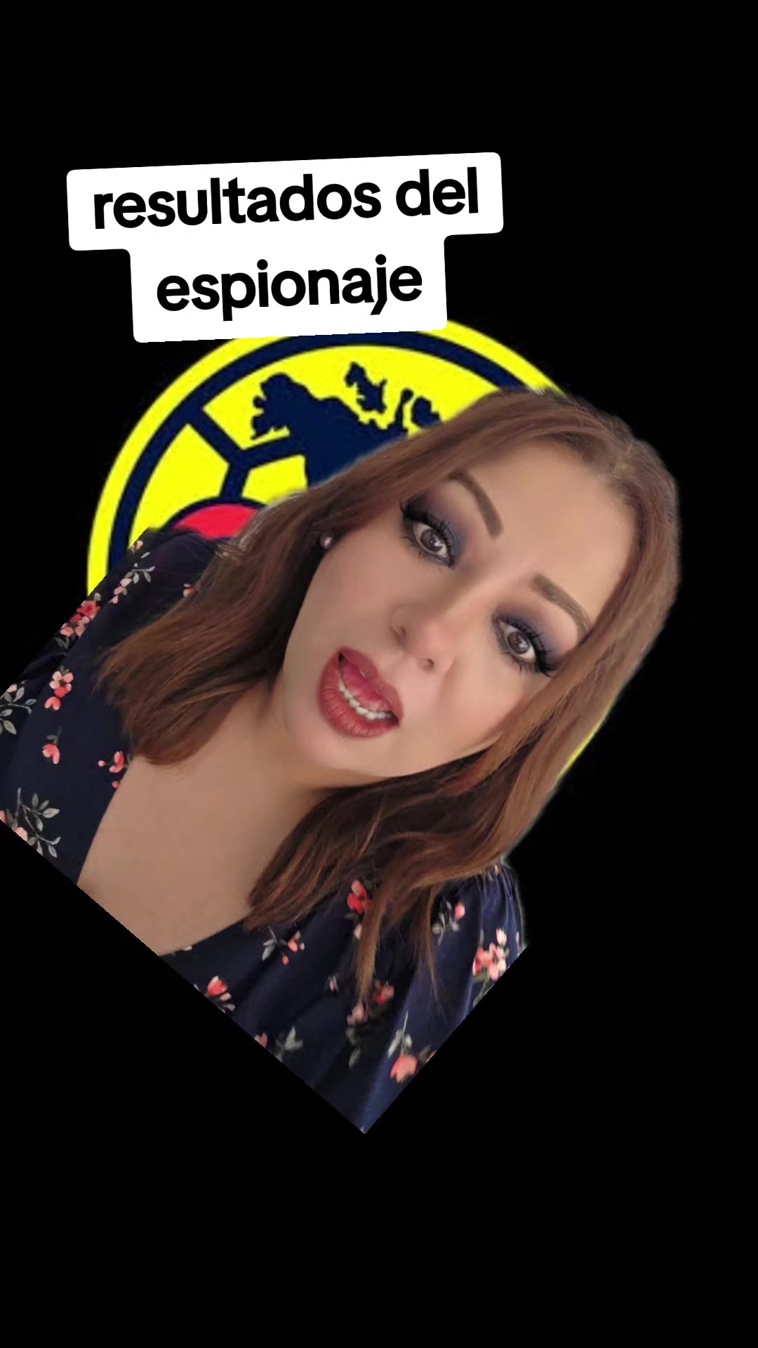 @Zo&iacute;