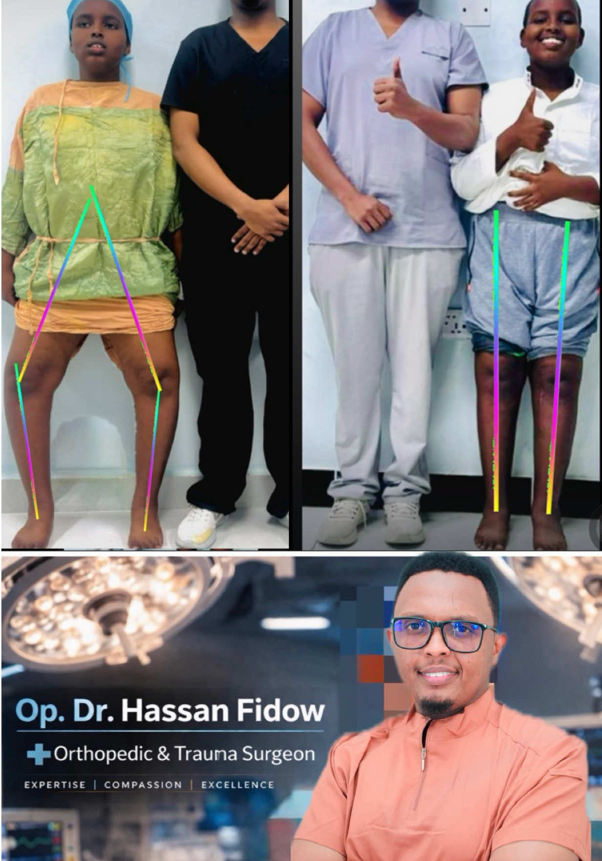 @DrHassan Fidow