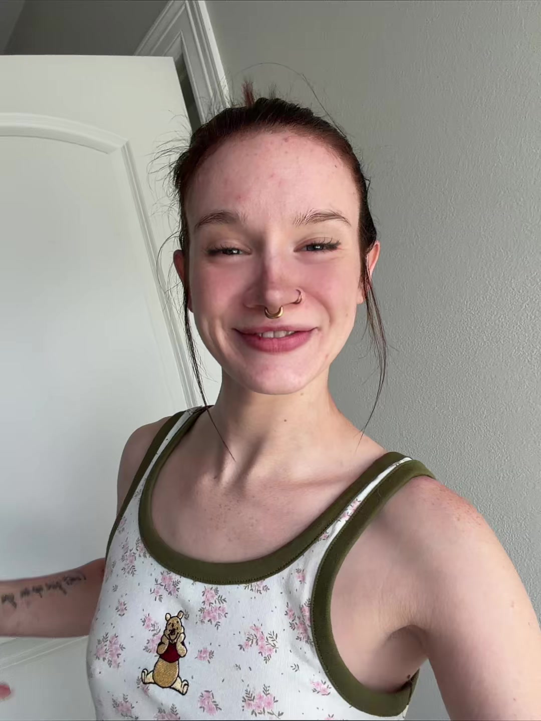 @kenzieesnutzfitinyomouth