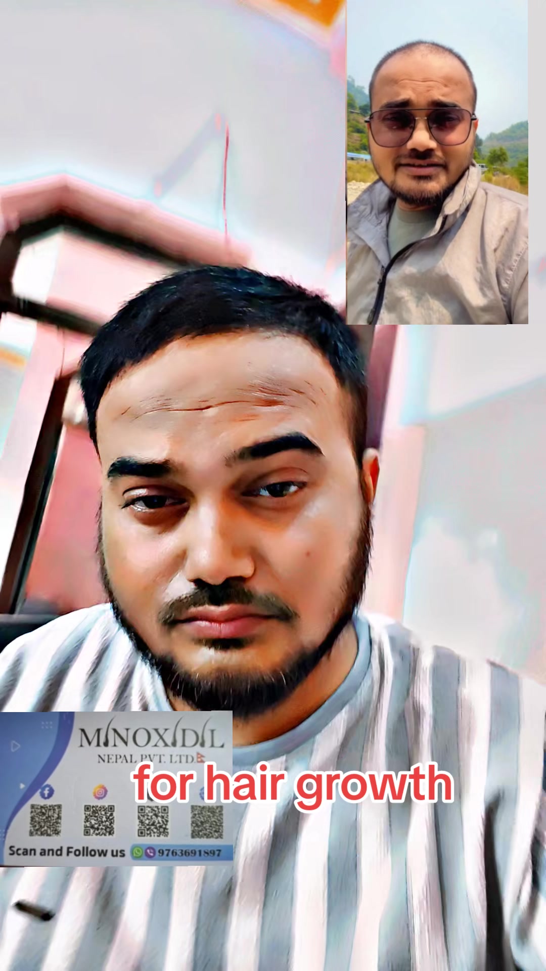 @DipeshSingh. 🕸🕷