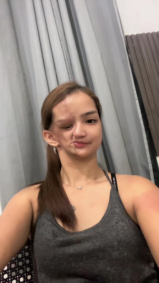 @Charene Treso