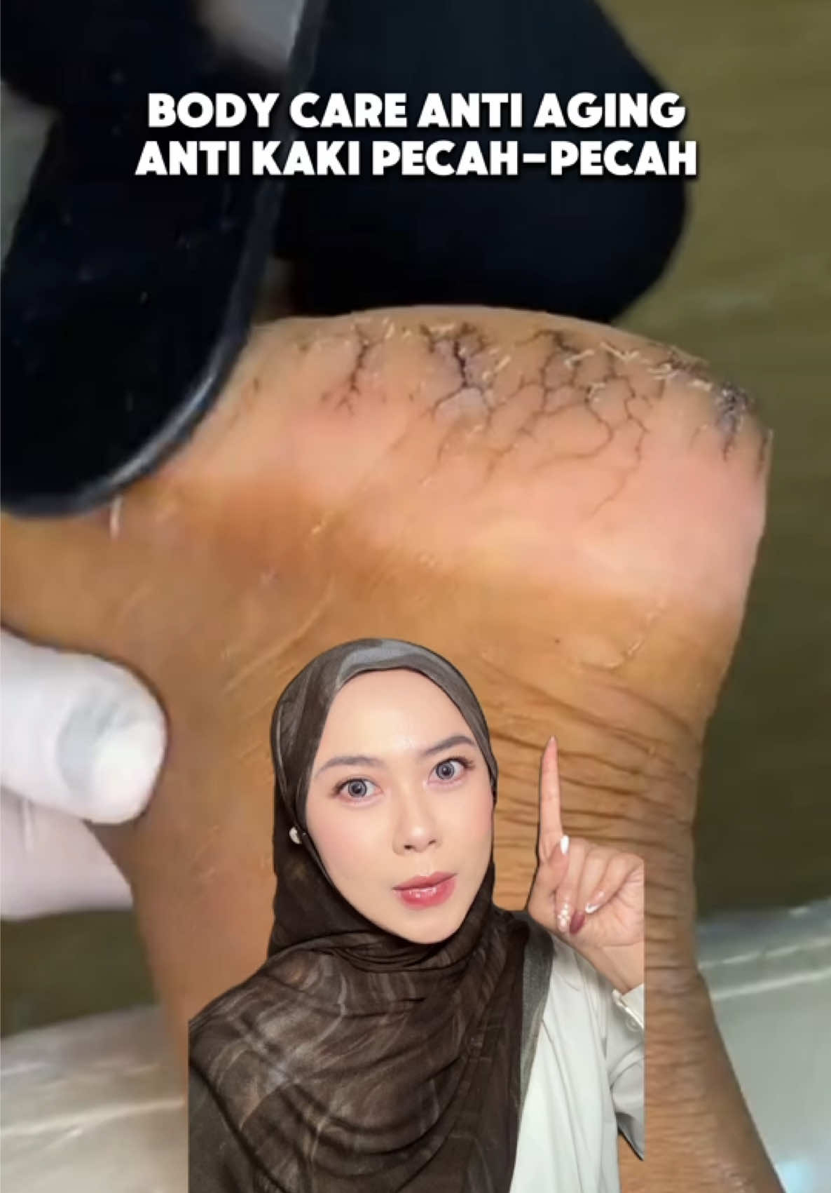 @Nonatyas