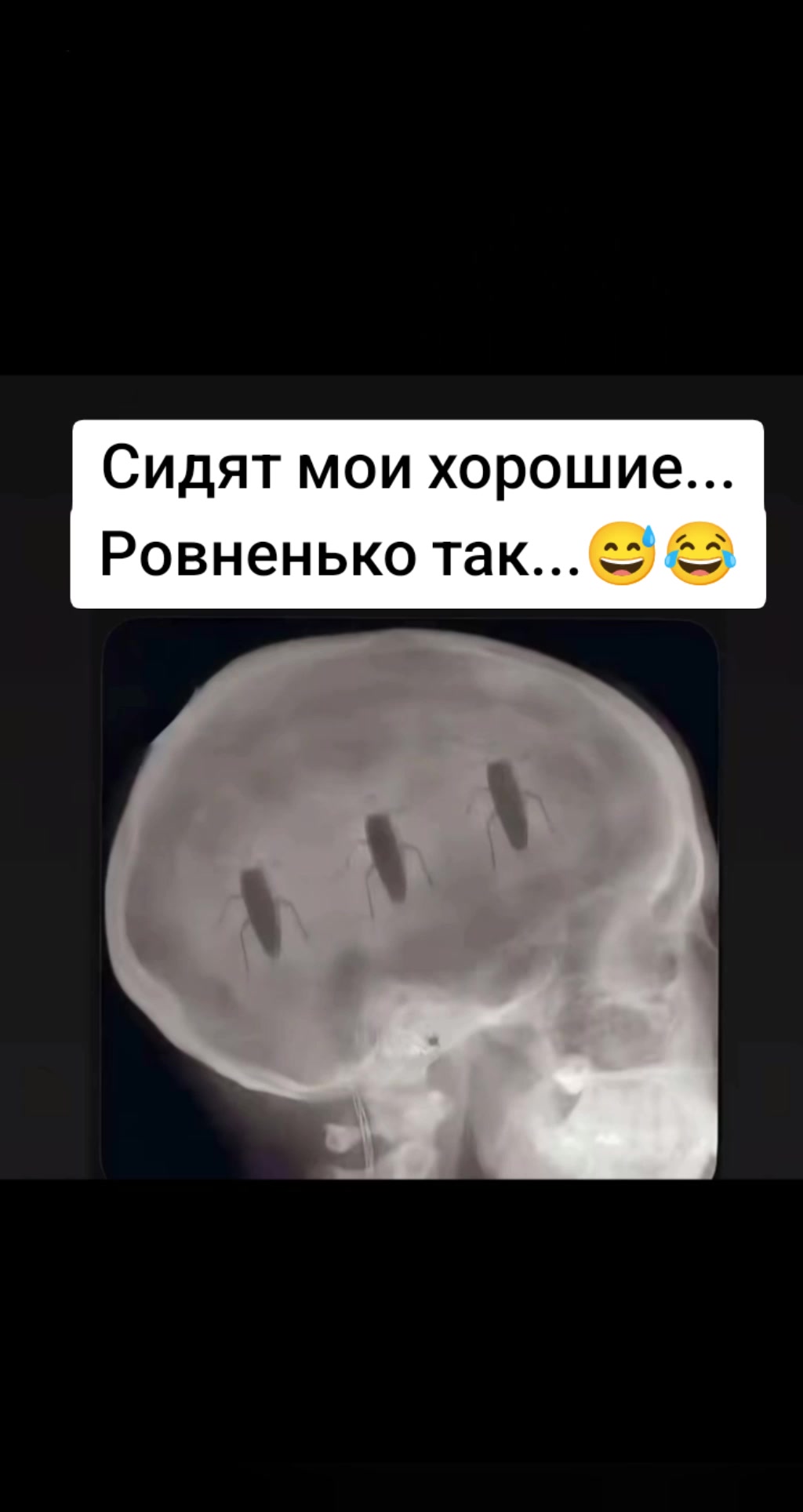 @Glazastik💋🇺🇦🦂