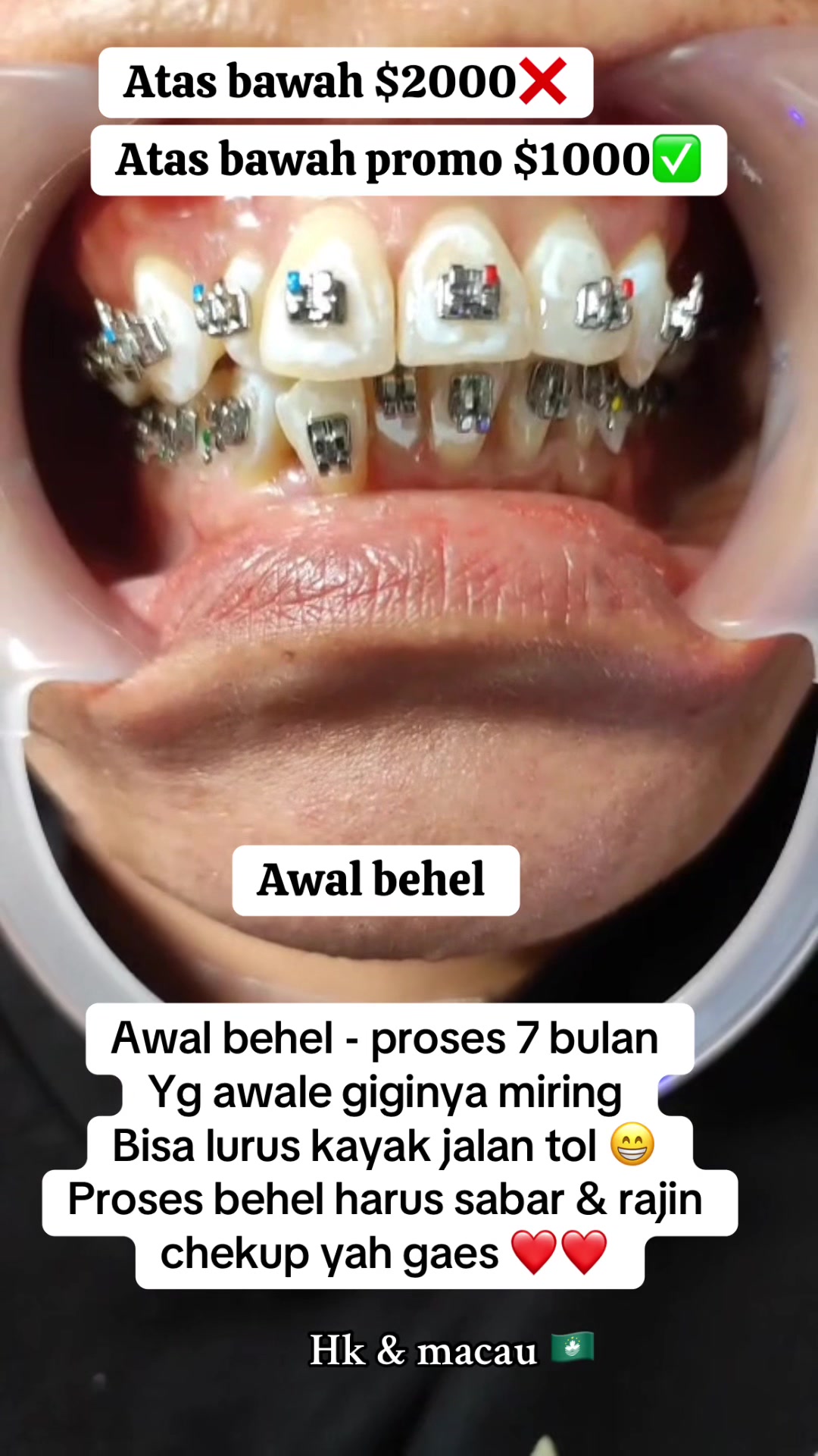@mbak-Paijem