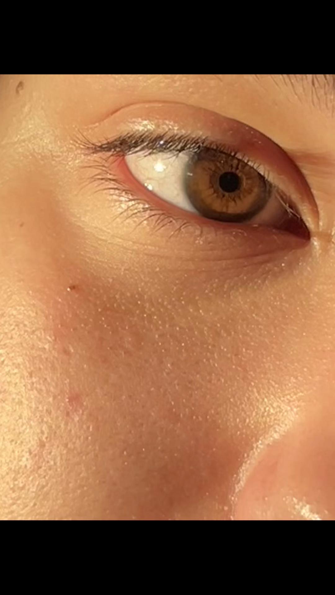 @♡