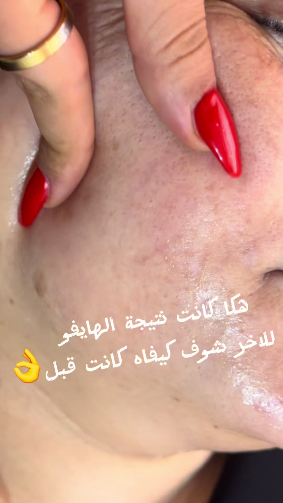 @Bibi skin Care Academy