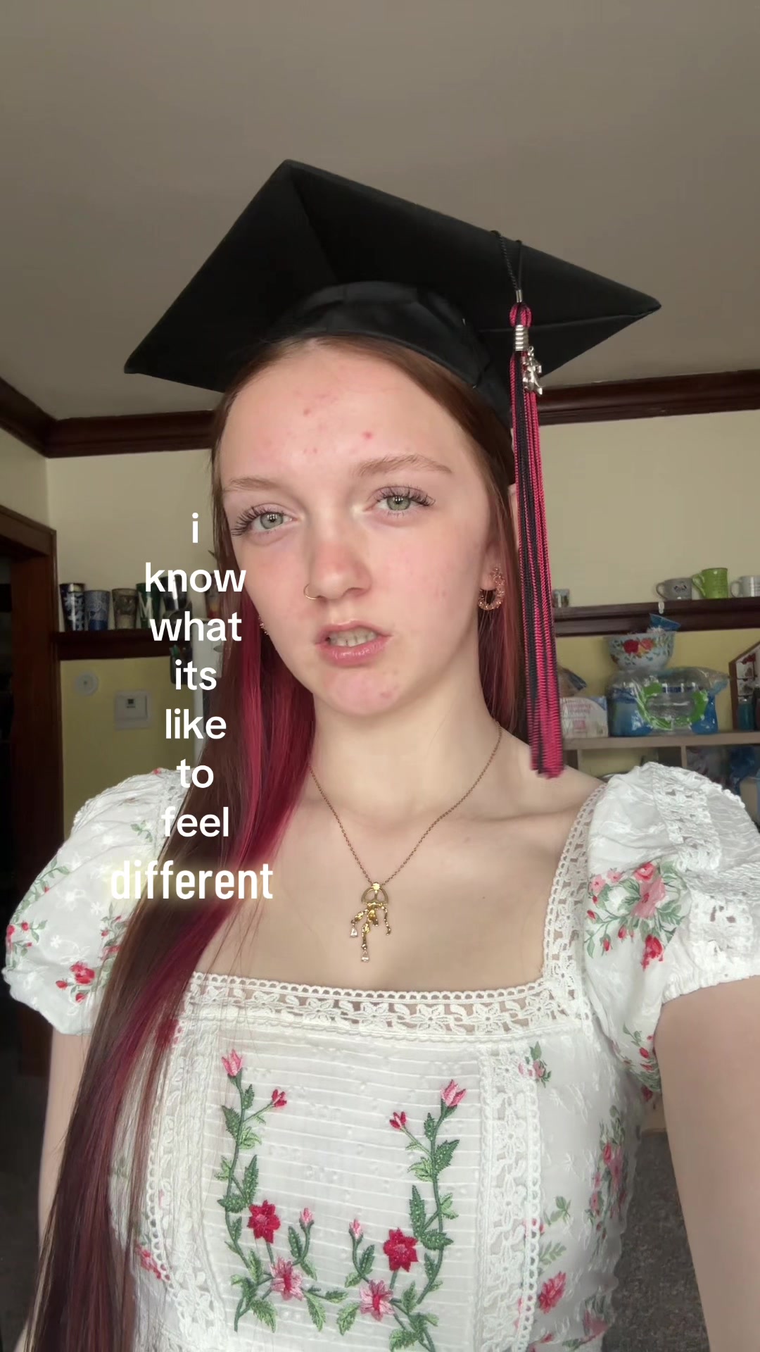 @🪼